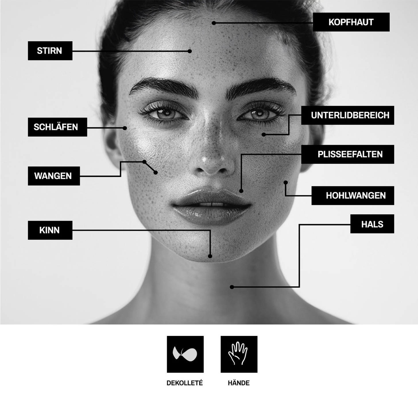 Mesotherapie Zonen